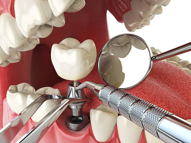 Best Mobile Emergency Dentist in Vernon, TX